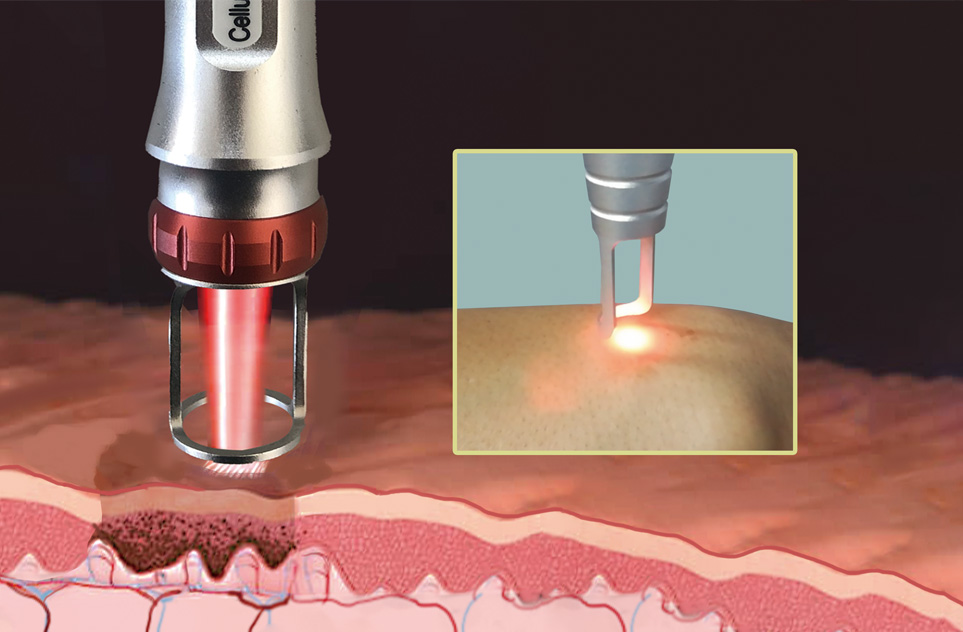 Treatment of Pigmentary Skin Disorders