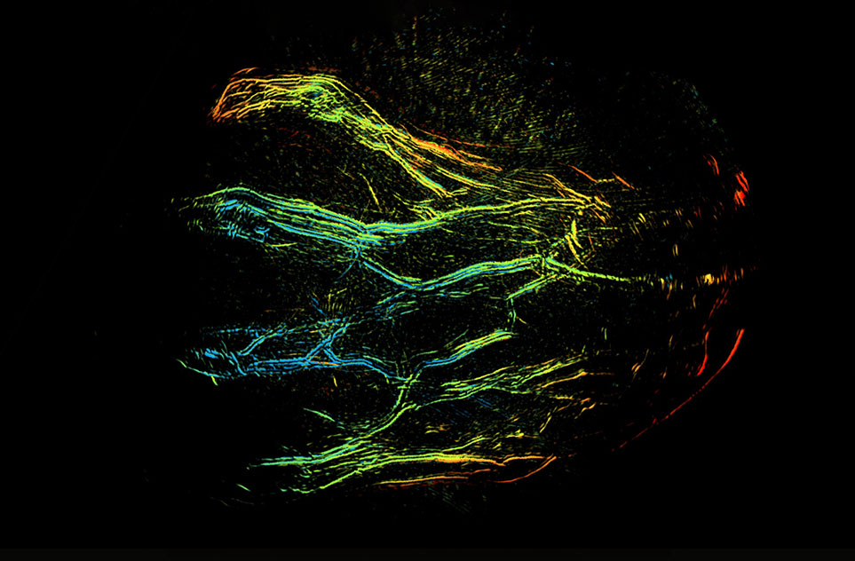 Photoacoustic Imaging