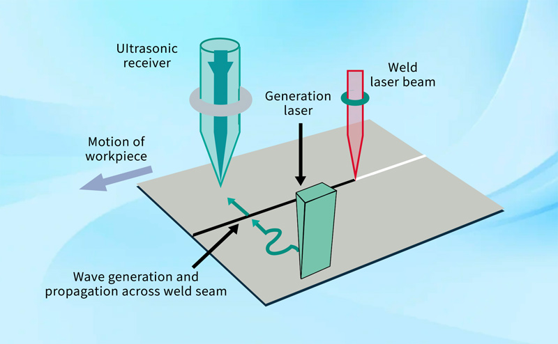 Laser Ultrasound